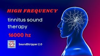 Tinnitus Relief Experience the Power of 16000 Hz Tinnitus Sound Therapy [upl. by Salomo61]