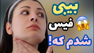 لیفت خارق العاده صورت با روش دوران باستان [upl. by Alanson285]