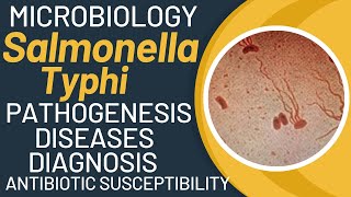 Salmonella typhi microbiology  Typhoid fever pathogenesis by salmonella typhimurium [upl. by Naved]