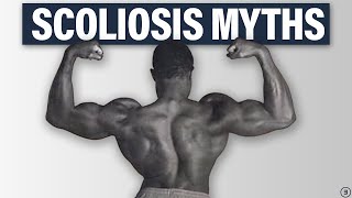 5 Facts You NEED to Know About Scoliosis Best Exercises Back Pain Performance and More [upl. by Willamina382]