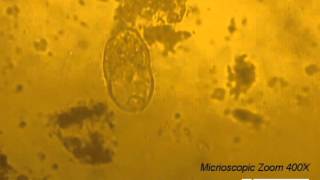 Parasitology Video Balantidium coli in TYIS33 medium  Clip 2 [upl. by Teagan669]