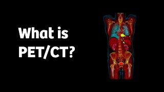 What is PETCT and how does it work [upl. by Thgiwed593]