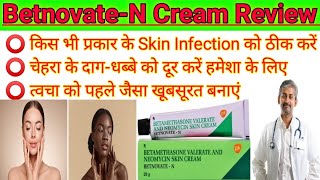 BetnovateN। BetnovateN Skin cream review 2023। How to uses betnovate n skin cream on face। [upl. by Annahsal]