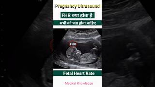 Pregnancy report में FHR क्या होता है  Pregnancy ultrasound report देखना सीखे pregnancy [upl. by Sulihpoeht]