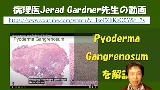 Pyoderma gangrenosumの病理組織像の解説動画 [upl. by Fornof]