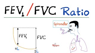 FEV1 FVC Ratio  Pulmonary Medicine  Obstructive VS Restrictive Lung Disease  Respiratory Physio [upl. by Haliled]