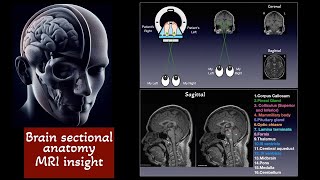 Brain Sectional anatomy on MRI Basa ganglia Caudate nucleus Putamen Globus pallidus [upl. by Emixam383]