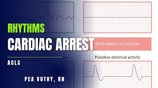 Cardiac Arrest Rhythms ACLS [upl. by Drhacir]