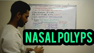 NASAL POLYPS [upl. by Backer23]