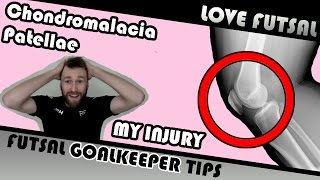 Injury update  Chondromalacia Patella  Runners Knee [upl. by Rozek]