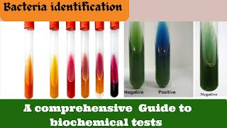 Identify Bacteria FAST with this Biochemical Test Microbiology [upl. by Grogan]