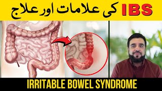 Irritable Bowel Syndrome IBS Kia Hai IBS ki Alamat aur Ilaj  Know the Symptoms amp Treatment of IBS [upl. by Niki827]