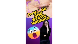 Unlocking the Secrets Dynamic vs Static Wrinkles Explained by Dr Shuyan  RJ Clinicquot [upl. by Nuawtna415]