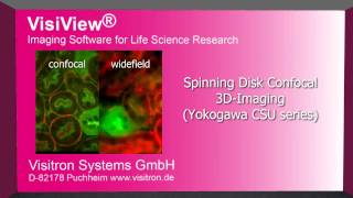 VisiView  High Preformance Imaging Software [upl. by Knorring]