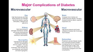 CHRONIC COMPLICATIONS OF DIABETES MELLITUS AND ITS PATHOGENESIS [upl. by Nozicka]