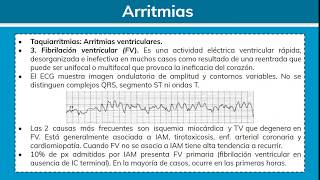 Arritmias Cardiacas 22  Clínica Médica Integral [upl. by Judd]