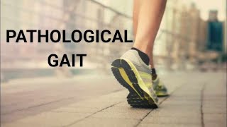 10 PATHOLOGICAL GAIT  Symptoms  causes and gait deviation analysis bhpiposchool [upl. by Ylrbmik]