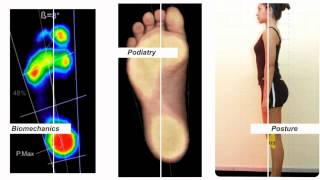 freeStep foot amp posture evaluation software [upl. by Allebasi]