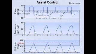 Ventilator Modes Mechanical Ventilation  Lecture 7 [upl. by Noirod381]