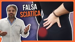 FALSA SCIATICA  Perchè il DOLORE AL GLUTEO non GUARISCE e RITORNA SEMPRE Trattamento OSTEOPATICO [upl. by Anirtek]