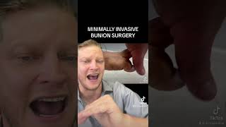 Minimally Invasive Bunion Surgery by Dr Roger Kilfoil [upl. by Lahtnero]