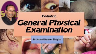 2 GENERAL PHYSICAL EXAMINATION IN PEDIATRICS [upl. by Seuqramed]