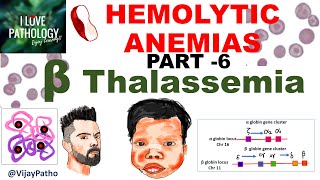 Hemolytic Anemias Part 6 Beta Thalassemia Pathogenesis types Diagnosis amp Treatment [upl. by Anecusa862]