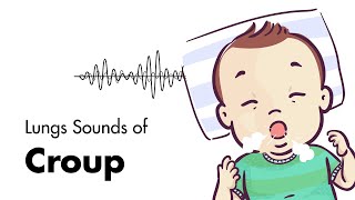 Sounds of Croup Laryngotracheitis  Lung Sounds  MEDZCOOL [upl. by Kaete885]