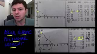 Spirometrie 8  recul elastic pulmonar crescut [upl. by Kory]