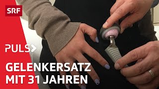 Arthrose Was hilft gegen den schmerzhaften Knorpelabbau in Knie und Hüfte  Puls  SRF Wissen [upl. by Wyler596]