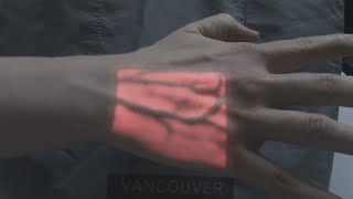 Vein Finder Technology [upl. by Archy450]