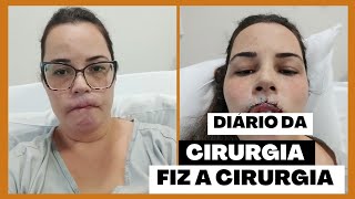 Fiz a cirurgia doeu bastante [upl. by Richards226]