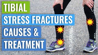 Tibial Stress Fractures  Treatment amp Healing Times [upl. by Niddala]