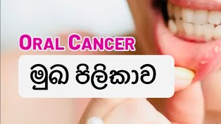 මුඛ පිලිකාව ගැන දන්නවද  oral cancer  Health tips sinhala [upl. by Htebzile862]