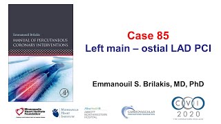 Case 85 PCI Manual  Ostial left mainLAD bifurcation stenting [upl. by Pember]