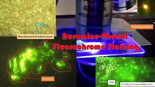 Mycobactrium tuberculosis in auraminephenol stained smear Fluorescensce Microscopy [upl. by Haret]