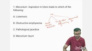 Neonatology MCQTopic 1 MECONIUM ASPIRATION SYNDROME mcq newborn education neet [upl. by September]