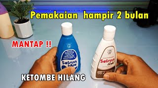 Review Selsun Shampoo Anti Ketombe amp Rambut rontok ❗ [upl. by Yrrol]