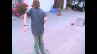 Kid Breaks Ankle Skateboarding [upl. by Eibbor872]