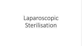 Laparoscopic Sterilisation  Family Planning [upl. by Mackoff]