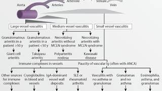 Dr Ayman Elsayed  Cutaneous Vasculitis Part 1  7122017 [upl. by Adok]