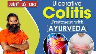 Ulcerative Colitis आँतों के घाव  Treatment with Ayurveda  Swami ramdev [upl. by Ainsley]