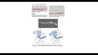 Emergency care chap 3  Airway management part 2 [upl. by Acinaj]