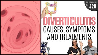 Diverticulitis Causes Symptoms amp Treatments  The ATP Project 429 [upl. by Eceinwahs]