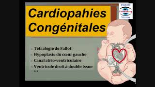 Cardiopathie congénitale cyanogène  fréquentes chez bébé malformation cardiaque Cours Cardiologie [upl. by Florence]