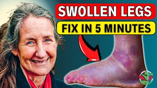 7 REMEDIES to Make SWOLLEN LEGS amp FEET Go Away in Minutes  Barbara O’Neills Secret [upl. by Cliff]