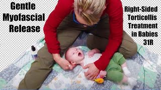 31R Gentle Myofascial Release RightSided Torticollis Treatment in Babies [upl. by Haden966]