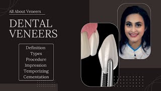 dental veneers explained [upl. by Mert594]