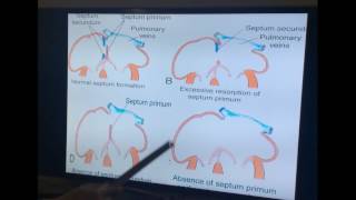 Embryology of Cardiovascular System  Part II by Dr Vijaya  Cardiac Septa amp Ventricles [upl. by Nyrahs]