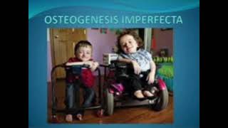 Osteogenesis imperfecta mrcpch Clinical [upl. by Chema345]